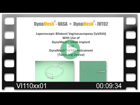 DynaMesh®-VASA /-IVT02 - Laparoscopic Bilateral Vaginosacropexy (laVASA)