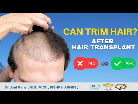 Can I Trim My Hair After Hair Transplant?