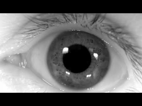 What is Voluntary Nystagmus and why is it so strange?