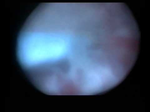 Rajani Hospital Video 1