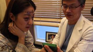 preview picture of video 'JW Plastic Surgery Korea - Agri Velt, Reiee Kok & Agnes (Part 3)'