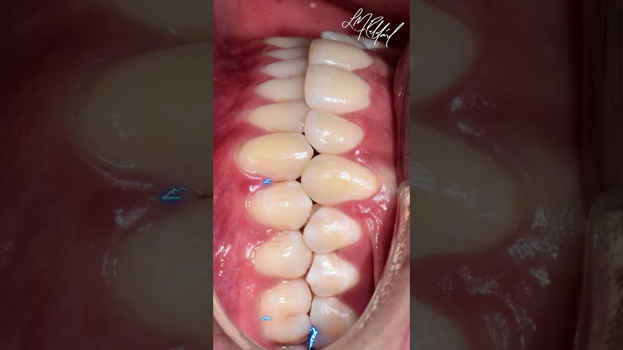 Lina María Roldán Lopera-11