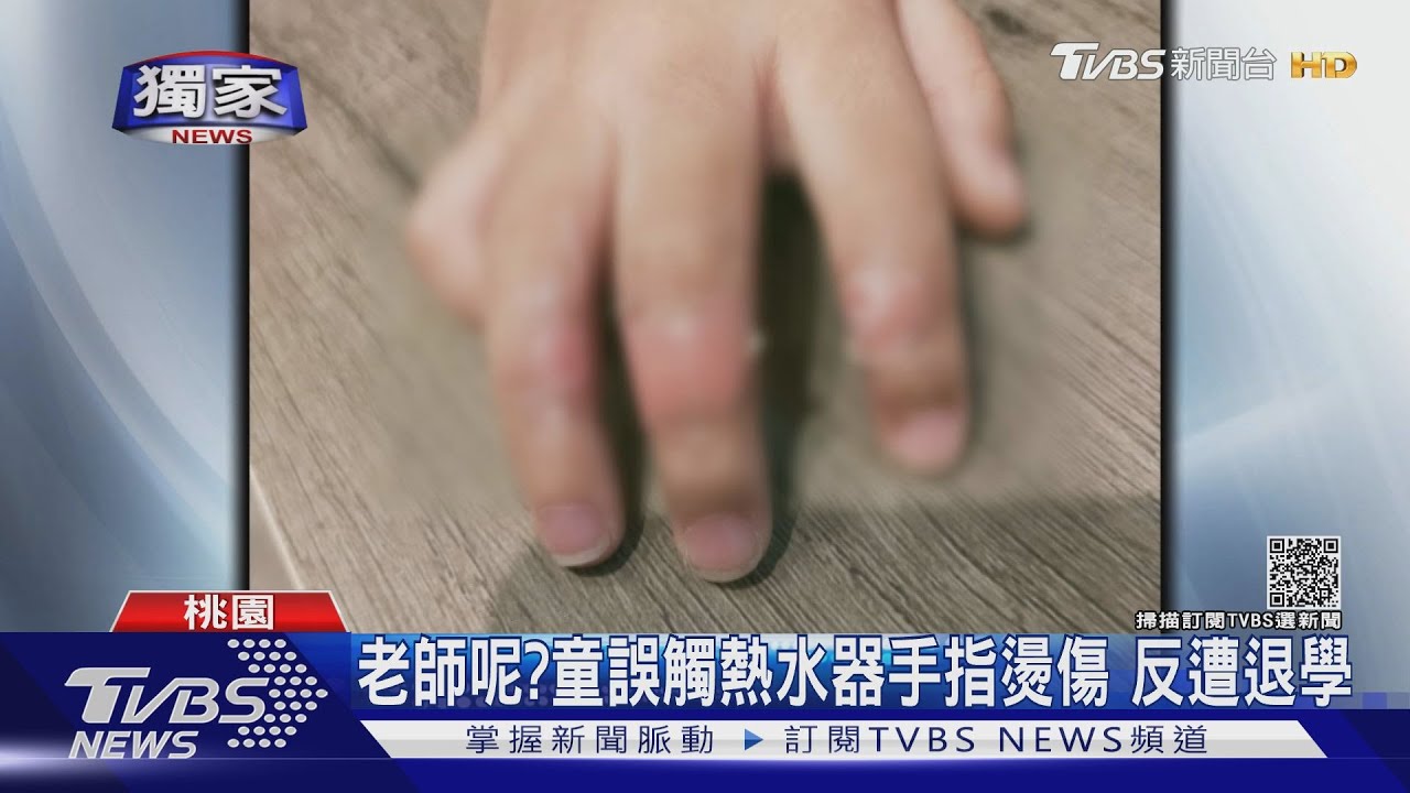 老師呢?童誤觸熱水器手指燙傷 反遭退學