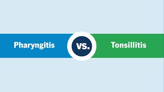 Pharyngitis vs. Tonsillitis