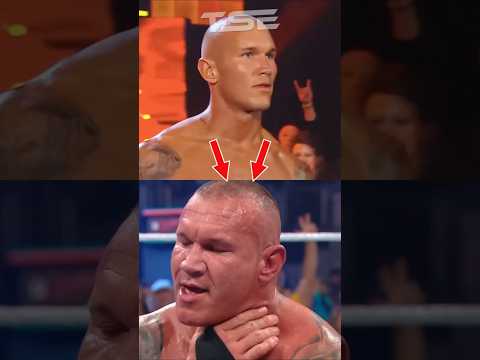 Why Has Randy Orton's Head Gotten Bigger? 😨
