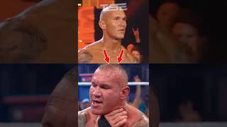 Why Has Randy Orton&#39;s Head Gotten Bigger? 😨