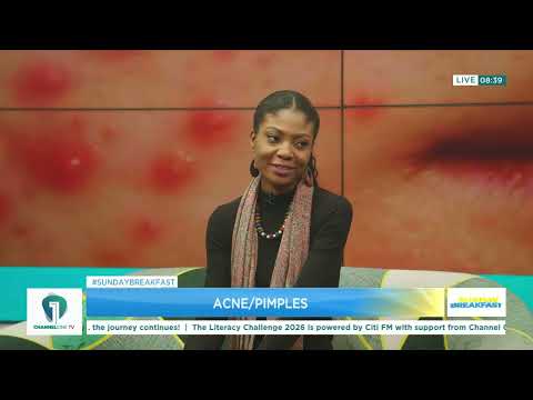 Acne & Pimples Explained: What You Need to Know From Dr Olum-Kalsoum Zakaria Adam