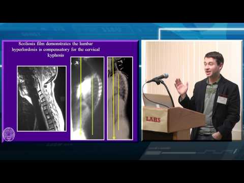 Global Spinal Balance