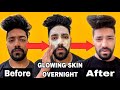 How To Get Fair & Glowing Skin For Men Naturally | Tips & Home Remedy | Hindi