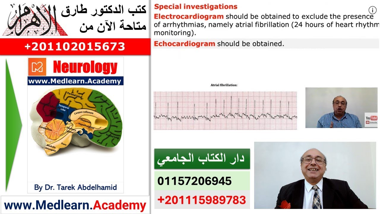 Transient Ischemic Attacks TIA  (2)  #CME #internal_medicine #usmle #محاضرات_باطنة