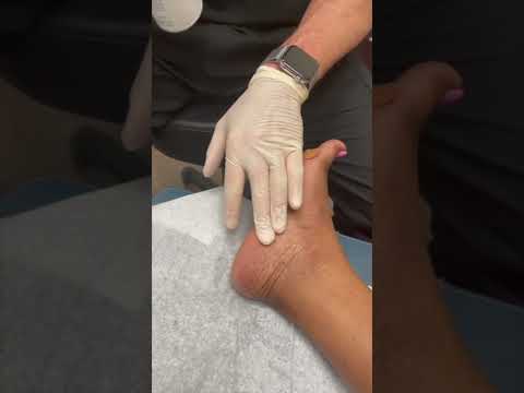 Ask Dr Moore Foot and Ankle FAQ Frequently Asked Questions Video Offering