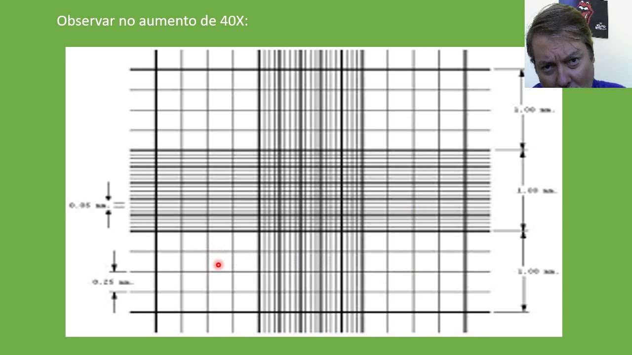 Técnicas laboratoriais I   Aula 04   Exame microscópico do EAS   vídeo aula