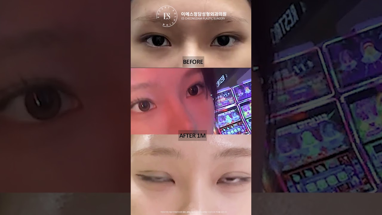 이에스 유튜브