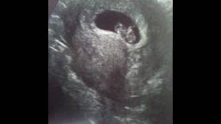 Ramzi Theory "Girl or Boy"