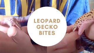 Leopard gecko bites | Everything you need to know