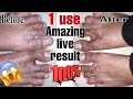 1 Use💯Amazing result with LIVE😱,Home Remedy for Cracked foot,remedy for cracked heels,cracks remedy