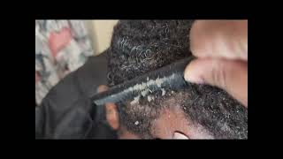 Dandruff Scratching | Channel Update!