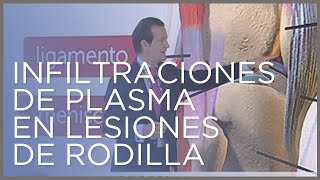 Cómo funcionan las infiltraciones de plasma en lesiones de rodilla