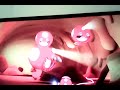 Les Octonauts Les Oursins D Eau