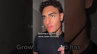 Download lagu Beard Growth Update (Week 3) - Beard Growth Kit, Copenhagen Grooming. mp3 Download lagu Beard Growth Update (Week 3) - Beard Growth Kit, Copenhagen Grooming. mp3