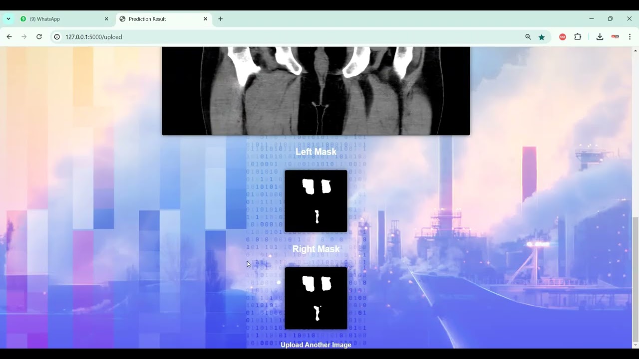 Kidney Tumor Segmentation in Python Projects