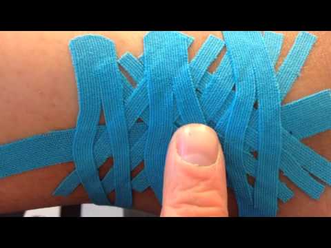 Forhåndsvisning av YouTube-video om kinesiotaping