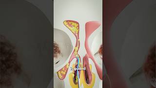 Balloon Sinuplasty Explained 🤔 Surgeon Reacts