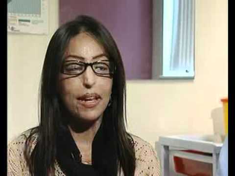 Mr Raman Malhotra rebuilds eyelids