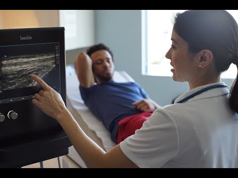 Sonosite: This is Point-of-Care Ultrasound