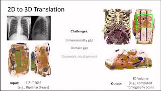 Download the video "ICCV 2023 - Unaligned 2D to 3D Translation with Conditional VQ Code Diffusion using Transformers"