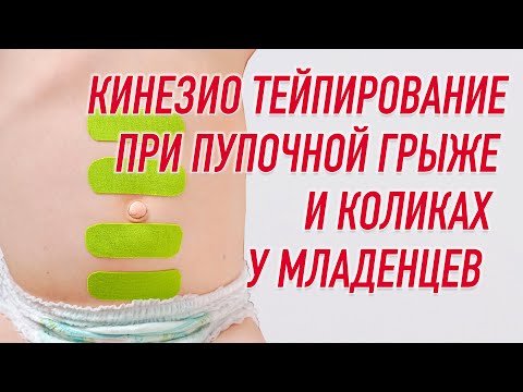 Кинезио тейп BBTape™ 5 см × 17 м бежевый (серия SMILE) Фото 12