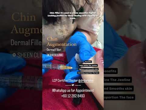 Precision Contouring: Chin Augmentation at Sheen Clinic