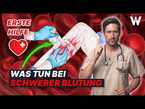 Unfall und starke Blutung sofort stoppen: Was tun - Notarzt erklärt