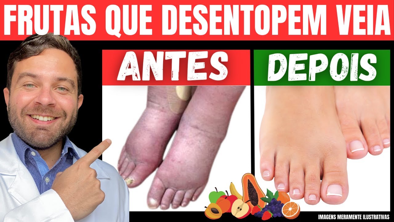 7 AMAZING FRUITS to COMBAT POOR CIRCULATION, VARIOUS VARCES and LEG PAIN