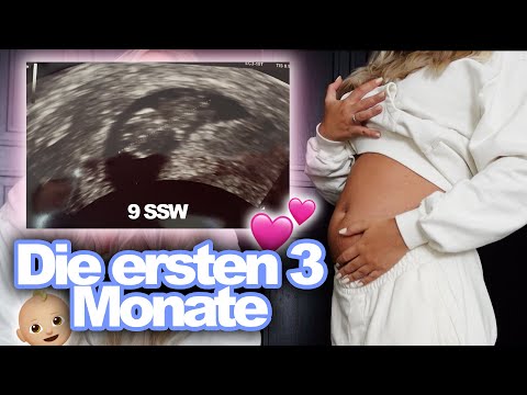 Ersten Ultraschallbilder, Übelkeit &amp; Veränderungen ?? Eure Fragen zum 1. TRIMESTER / 1-13 SSW | Dagi