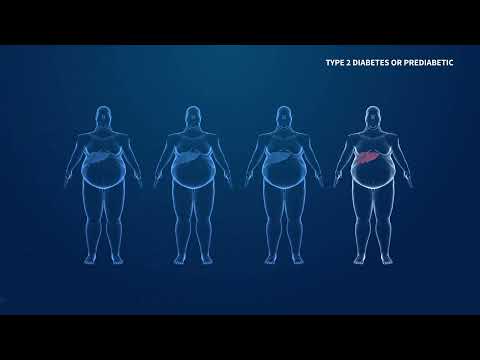 What Are Comorbid Conditions