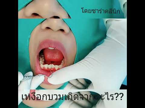 สำหรับการป้องกันแรงสมุนไพร Pussies ของเล็ก ๆ น้อย ๆ และสมาชิกในหนังโป๊