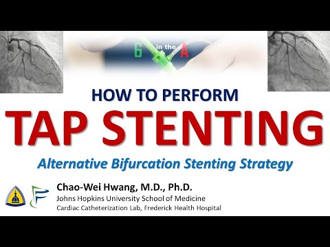 TAP Stenting - an alternative bifurcation stenting strategy