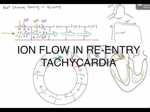 Ion Flow in Re-Entry Tachycardia