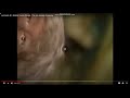 Jack And Jill Falling Down