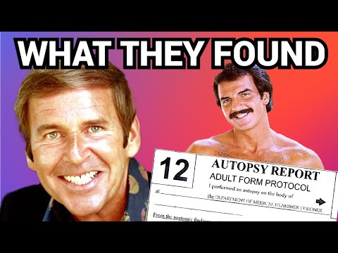 The REAL Story of Paul Lynde's Death: Autopsy Facts and the Hotel Incident