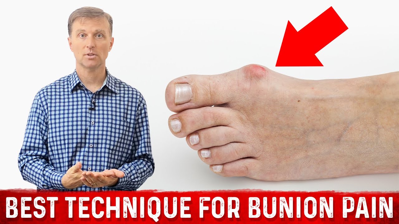 Bunion Pain Relief – The Simple & Best Technique by Dr.Berg - YouTube