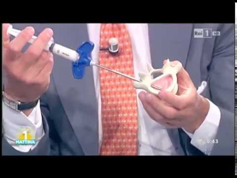 Frattura ago nella caviglia Riabilitazione delle articolazioni secondo la procedura Bubnovskaya