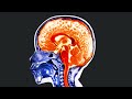 A Boy Drank His Mom's Essential Oils. This Is What Happened To His Brain.