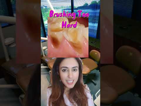 3 Causes Of Yellow Teeth 🟡💛🦷! #shorts