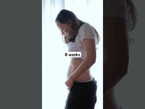 Reminiscing on my TWIN pregnancy tummy 💕 the transformation is crazy! #shorts #twins #pregnancy