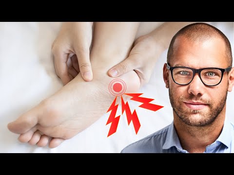 ZAPALENIE ROZCIĘGNA PODESZWOWEGO - Wszystko co musisz wiedzieć!