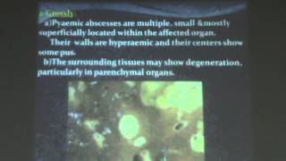 13) Dr.Amal Haridy 12-11-2015 [ Tuberculosis Part 1 ]