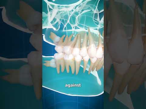 , title : 'Impacted Wisdom Teeth 😮 (Explained)'