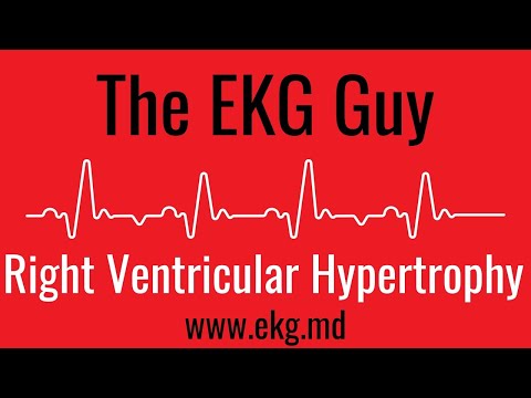 Right Ventricular Hypertrophy on EKG / ECG l The EKG Guy - www.ekg.md